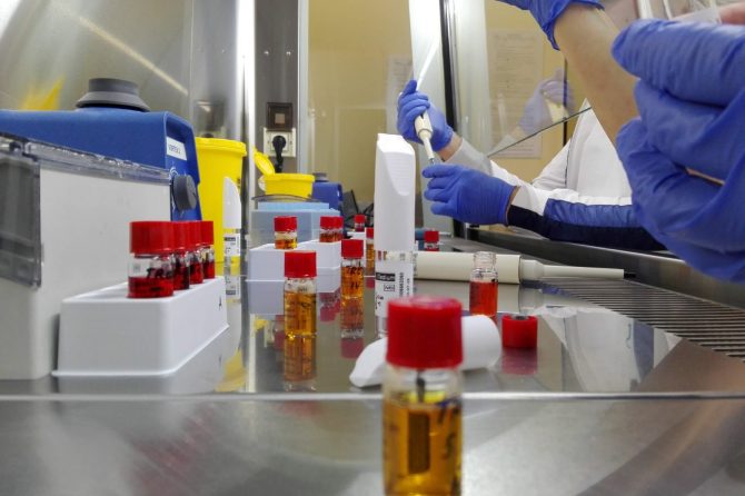 Mikrobiološka laboratorija Zavoda kao deo evropskih istraživanja